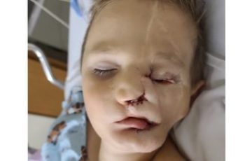 Boy, 5, survives savage attack by two dogs only to be called a ‘monster’ in public